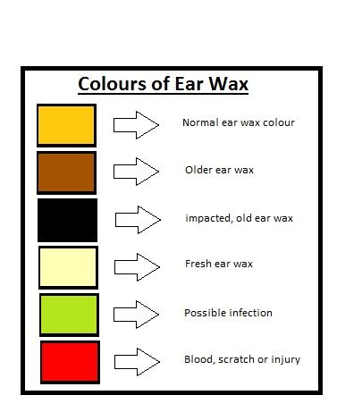 Impacted ear wax tinnitus top